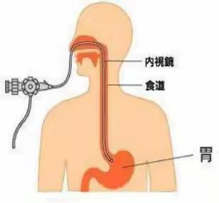 “胃”你守护，健康“肠”驻    ——胃肠镜检查科普知识