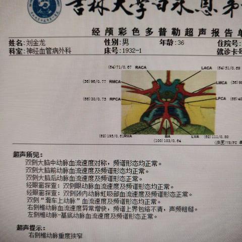 2024-3-28焦玉贵，男，65岁，TIA发作，右侧颈内动脉狭窄