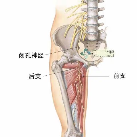 髋周痛--神经痛之闭孔神经痛？