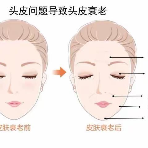 头皮抗衰真的“靠谱”吗？