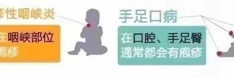 【健康知识】手足口病与疱疹性咽峡炎