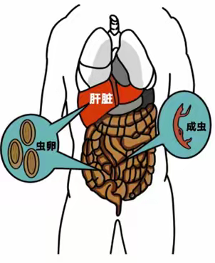 传染病知识速览——血吸虫病