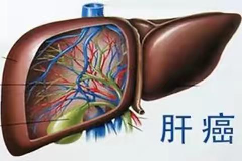 肝癌知识
