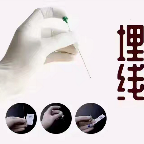 中医养生｜体重管理之中医“穴位埋线”