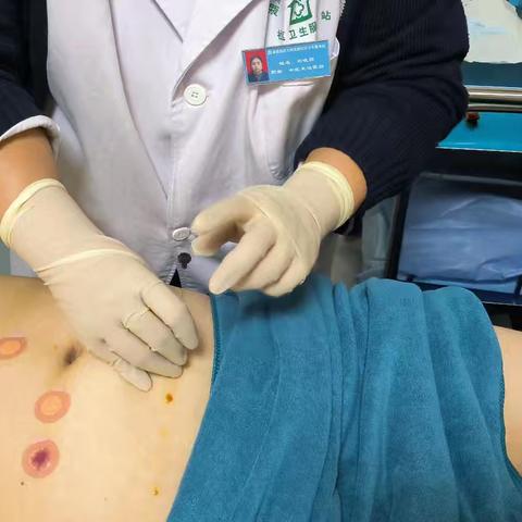 中医减肥黑科技——穴位埋线，不止能“瘦”，还能治很多病！