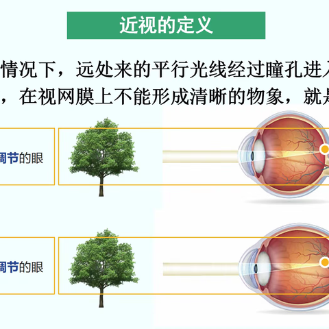 眼睛，心灵的窗户：山阴小学节假日给孩子们的一封信