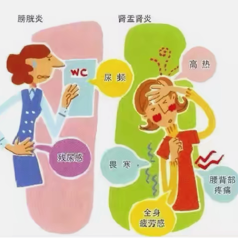 【健康知识之窗】泌尿系感染疾病指导