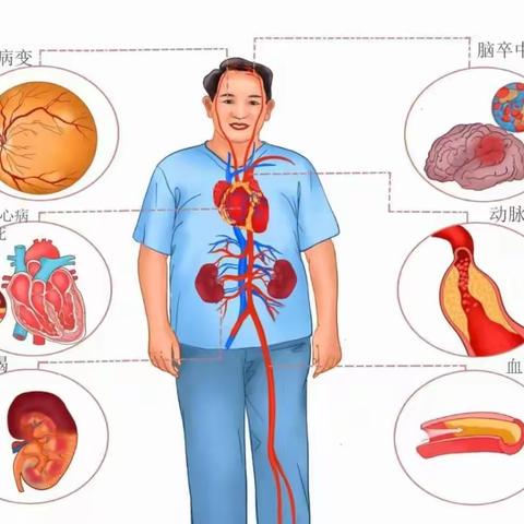 你想知道的高血压科普知识全在这里