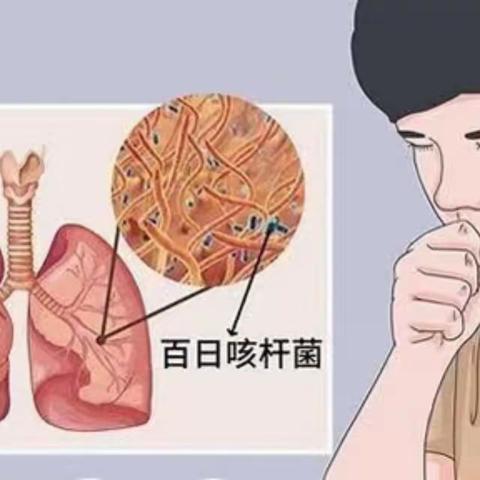 真正的“手足口病疫苗”，终于要来了！