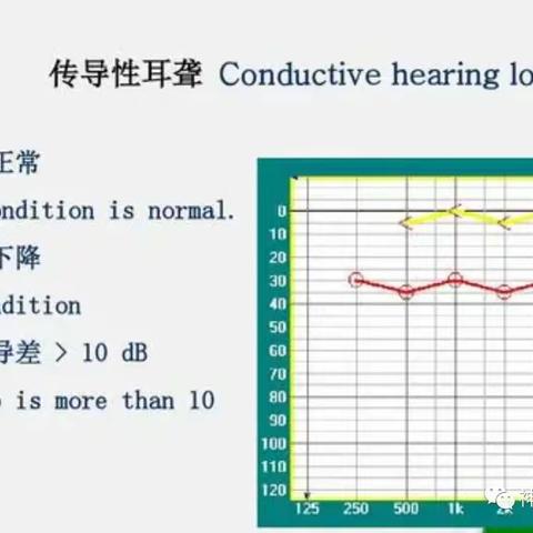 不同类型的听力损失早期有什么表现呢？