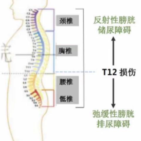 神经源性膀胱