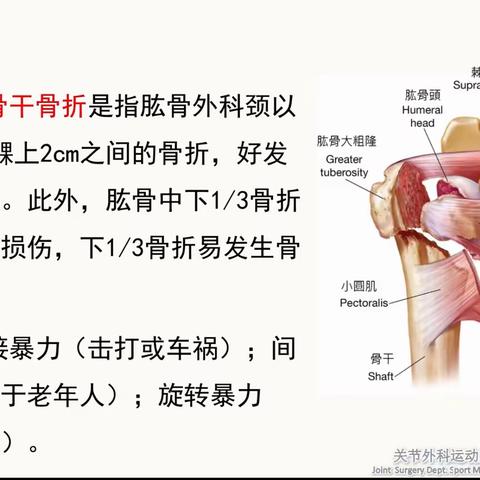 肱骨干骨折术后的功能锻炼