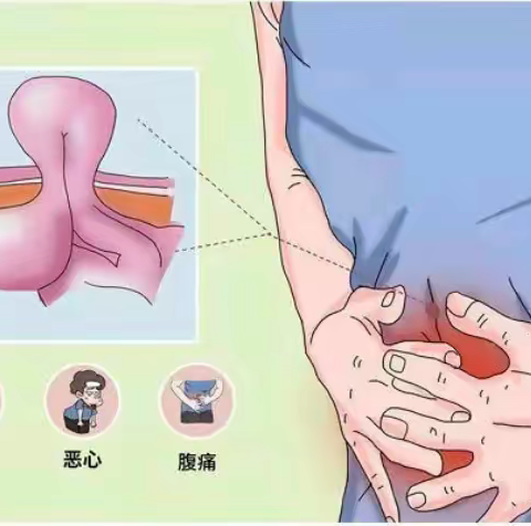 【公卫科普】腹股沟疝：一种被很多人忽视的普外科疾病