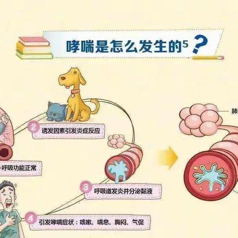 支气管哮喘的日常健康预防