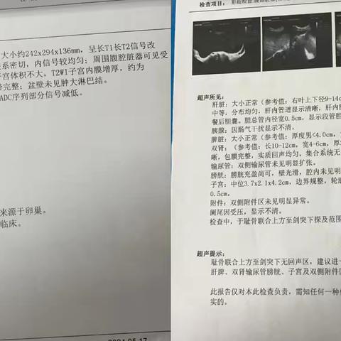 蓝田首例单孔妇科腔镜手术顺利完成