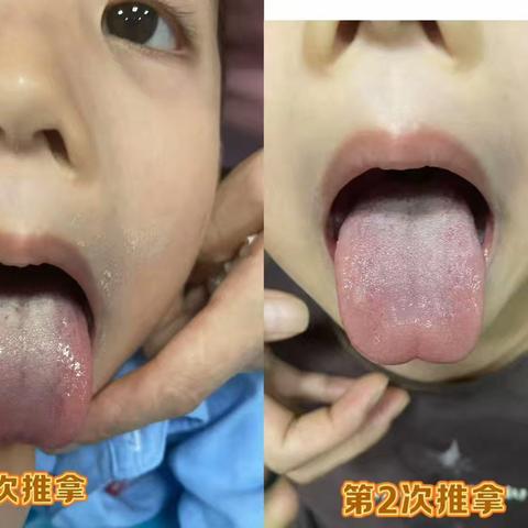 告别就医焦虑！儿科这波“一科一品暖心操作”直接封神✨