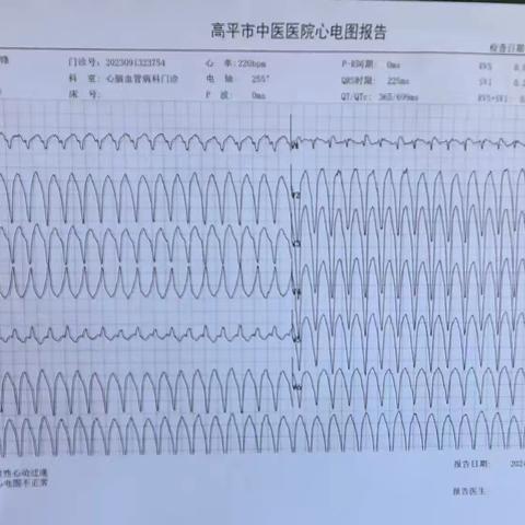 心电图危急值—室性心动过速