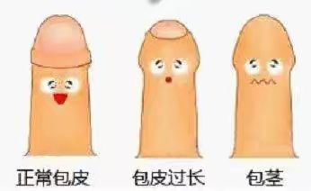 关于包皮那些事