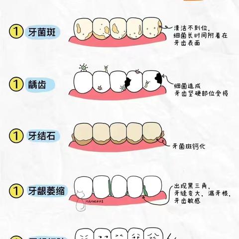 幼儿怎么保护牙齿