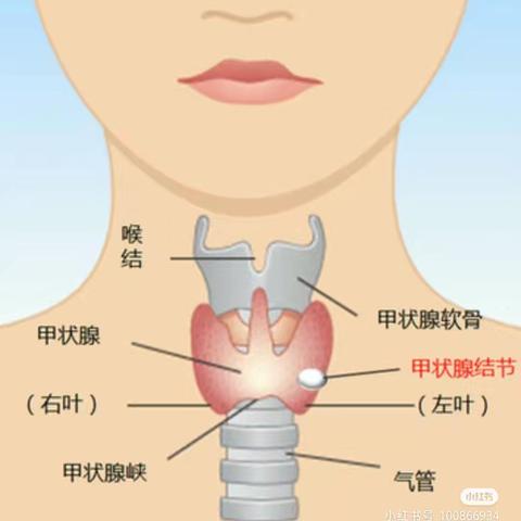 甲减是怎么回事？