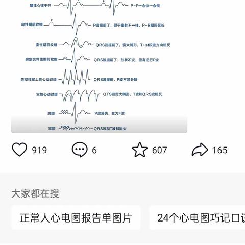 高血压健康宣教