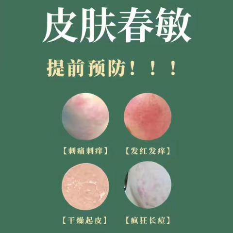 春敏如何预防