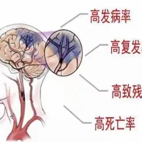 世界预防卒中日