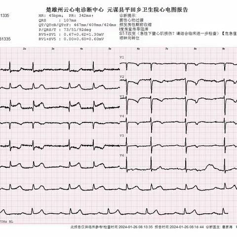 道阻且长，行则将至——心梗救治 我们一直在路上“加速” 元谋县平田乡卫生院成功开展一例STEMI患者规范救治