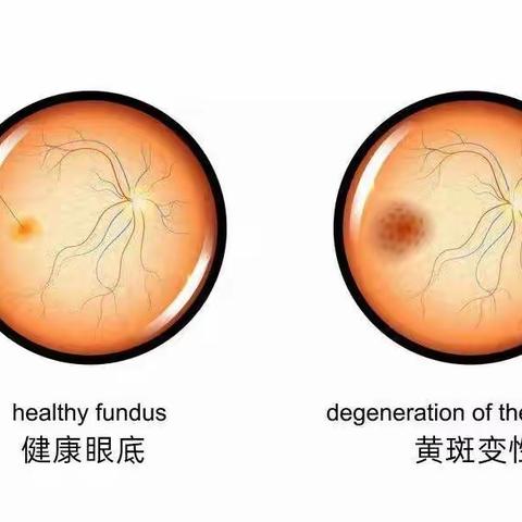 被称为“眼黄金”的叶黄素究竟是什么？叶黄素则能过滤蓝光！