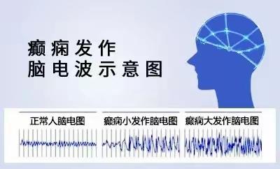 东安县人民医院神经内科开展新项目:肌电图、脑电图检查现正式运行！