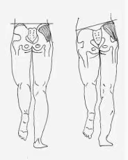 重心转移训练方法