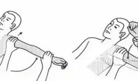 臂丛神经损伤训练