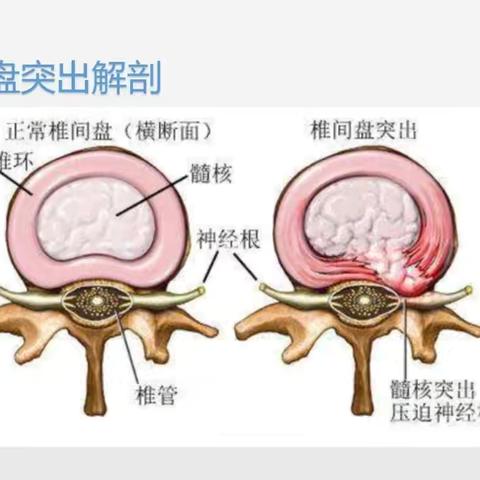 假如骨科医生说真话：这18个坑，千万别踩！