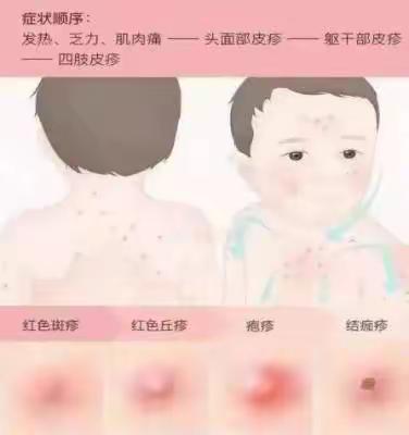 汉沽体育场小学——春季常见传染病知识小课堂