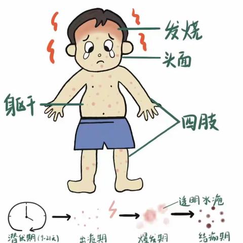 “知水痘 防水痘”——雨点幼儿园预防水痘知识宣传