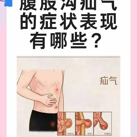 疝气无小事 健康不忽视—— 胃肠外科疝与腹壁外科疝气日义诊与健康科普讲座