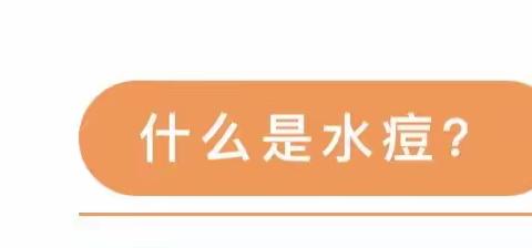 科学防护“水痘”—和布克赛尔县第一幼儿园水痘健康知识宣传