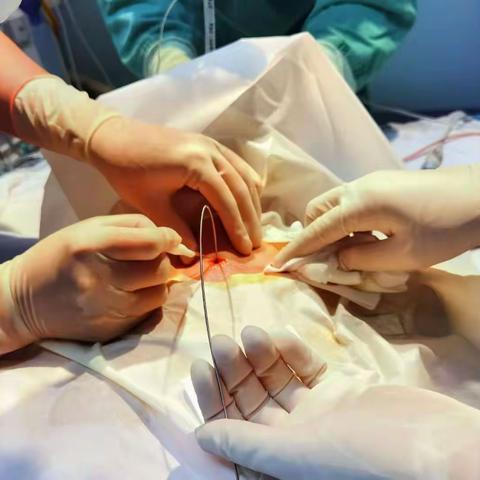 新技术｜纤支镜引导下经皮气管切开