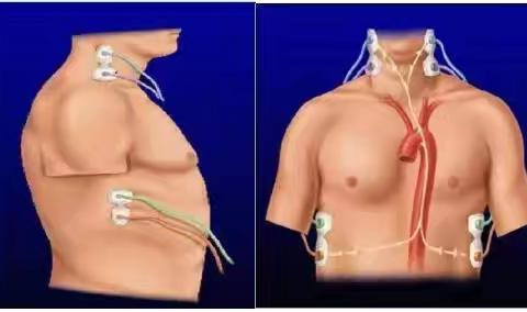 科普｜什么是“无创心功能检测”