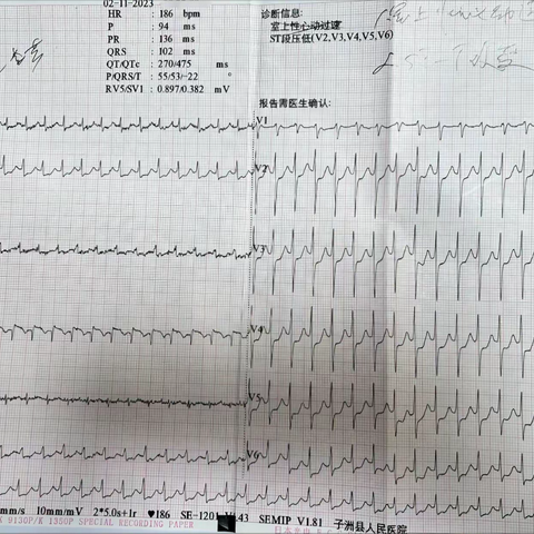 子洲县人民医院内一科团队成功抢救一例阵发性室上性心动过速患者