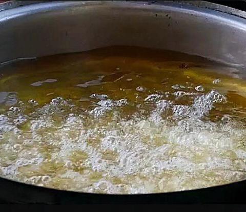 一例油烫伤案例