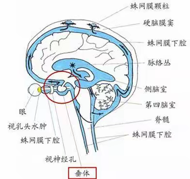 颅底骨折脑脊液漏健康教育