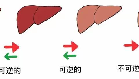 馆陶县中医院内九科健康大讲堂第1056讲-让我们一起认识脂肪肝