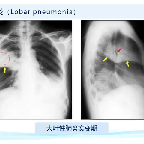 干戈起的简篇