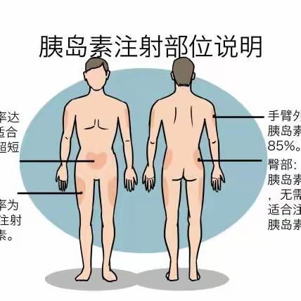 “药课堂”第一百六十四讲:图解胰岛素正确注射方式！