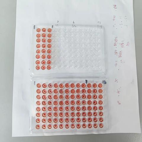 抚顺市疾控中心微生物检验科应用悬浮MDCK细胞分离培养流感病毒