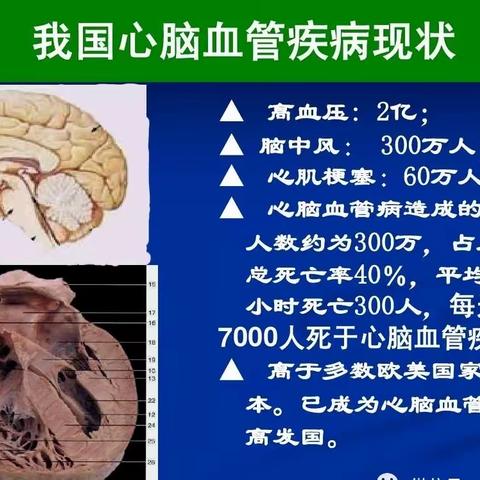 身体累了可以歇会儿，道路堵了可以疏通，心|脑|血|管|坏了可以用雪澈！