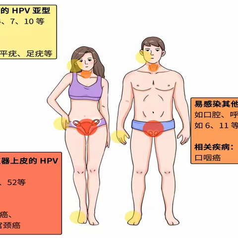 男人健康之路：包皮与HPV