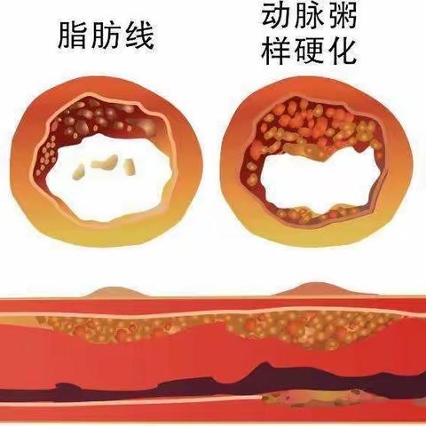 心脑血管健康再忽视就晚了！