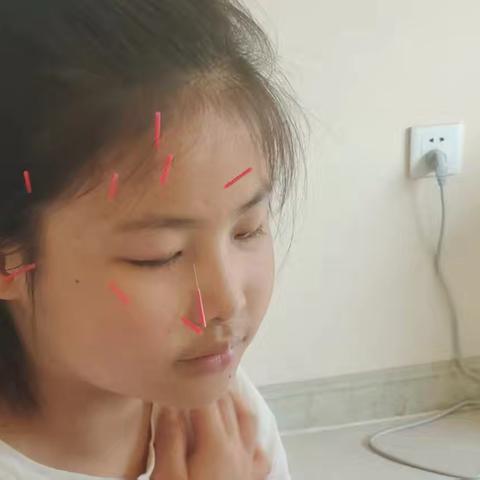 【锦旗故事】一面锦旗，一份信赖 ——管针守护童眸的温暖见证
